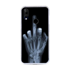 Load image into Gallery viewer, CALROVTE Case For BQ 6040L Wolf Silicon TPU Cover for BQ-6040L Magic Cat Animal Shell Bag Housing Phone Cases for BQ 6040 L